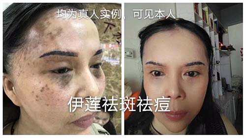 純中藥?kù)畎叽砑用苏猩? title=